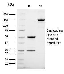 SDS-PAGE analysis of Anti-HER2 Antibody [HRB2/258] under non-reduced and reduced conditions; showing intact IgG and intact heavy and light chains, respectively SDS-PAGE analysis confirms the integrity and purity of the antibody