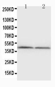 Anti-NPHS2 Rabbit Polyclonal Antibody