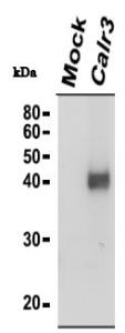 Anti-Calrecticulin 3 Antibody