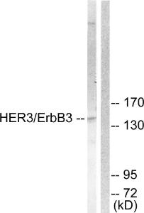 Western blot analysis of lysates from 293 cells, treated with LiCl 0.01 U/ML 15' using Anti-HER3 Antibody. The right hand lane represents a negative control, where the antibody is blocked by the immunising peptide