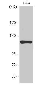 Western blot analysis of HeLa cells using Anti-HXK1 Antibody