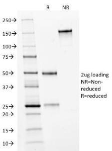 SDS-PAGE analysis of Anti-HER2 Antibody [HRB2/282] under non-reduced and reduced conditions; showing intact IgG and intact heavy and light chains, respectively. SDS-PAGE analysis confirms the integrity and purity of the antibody