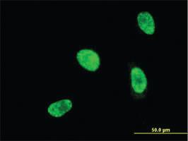 Anti-HOXA5 Mouse Monoclonal Antibody [clone: 4A8]