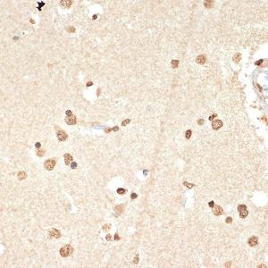 Immunohistochemistry analysis of paraffin-embedded human brain tissue using Anti-Histone H2A Antibody [ARC2072] (A307778) at a dilution of 1:100 (40x lens) Perform microwave antigen retrieval with 10 mM Tris/EDTA buffer pH 90 before commencing with IHC staining protocol