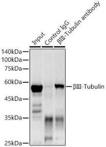 Immunoprecipitation analysis of 300 µg extracts of mouse brain using 3 µg of Anti-beta III Tubulin Antibody [ARC0456] (A309019) This Western blot was performed on the immunoprecipitate using Anti-beta III Tubulin Antibody [ARC0456] (A309019) at a dilution of 1:500