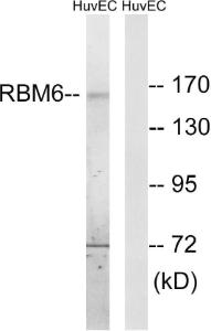 Western blot analysis of lysates from HUVEC cells using Anti-RBM6 Antibody. The right hand lane represents a negative control, where the Antibody is blocked by the immunising peptide