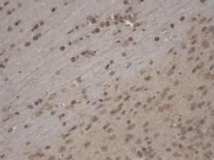 Immunohistochemistry analysis of mouse brain slice, fixed in 10% formalin solution for 12-24 hours at room temperature