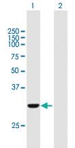 Anti-COASY Mouse Polyclonal Antibody