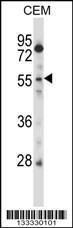 Anti-CSRNP2 Rabbit Polyclonal Antibody (AP (Alkaline Phosphatase))