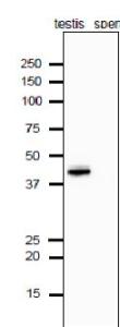 Anti-Calrecticulin 3 Antibody