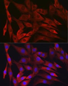 Immunofluorescence analysis of NIH/3T3 cells using Anti-IKK beta Antibody [ARC2632] (A306095) at a dilution of 1:100 (40x lens). DAPI was used to stain the cell nuclei (blue)