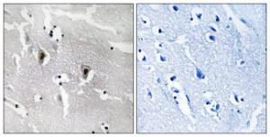 Immunohistochemical analysis of paraffin-embedded human brain tissue using Anti-RBM6 Antibody. The right hand panel represents a negative control, where the Antibody was pre-incubated with the immunising peptide