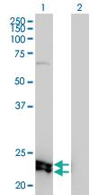 Anti-MREG Mouse Monoclonal Antibody [clone: 8F9-1B2]