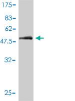 Anti-CD1A Mouse Monoclonal Antibody [clone: M1-2-1B5]