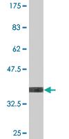 Anti-UGT2B4 Mouse Monoclonal Antibody [clone: 2H6]