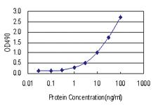 Anti-ATF1 Antibody Pair