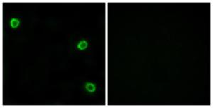 Immunofluorescence analysis of LOVO cells using Anti-OR51Q1 Antibody. The right hand panel represents a negative control, where the antibody was pre-incubated with the immunising peptide.