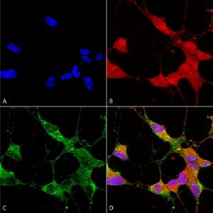 Immunocytochemistry/Immunofluorescence analysis of human neuroblastoma cells (SH-SY5Y), fixed in 4% PFA for 15 min, using Anti-TRPC5 Antibody [N67/15] (A304954), at 1:50 for overnight at 4°C with slow rocking