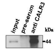 Anti-Calrecticulin 3 Antibody