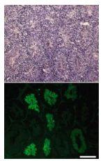 Anti-Calrecticulin 3 Antibody