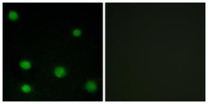 Immunofluorescence analysis of COS7 cells using Anti-RBM6 Antibody. The right hand panel represents a negative control, where the Antibody was pre-incubated with the immunising peptide