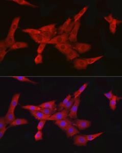 Immunofluorescence analysis of PC-12 cells using Anti-IKK beta Antibody [ARC2632] (A306095) at a dilution of 1:100 (40x lens). DAPI was used to stain the cell nuclei (blue)