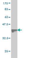 Anti-ST6GAL1 Mouse Monoclonal Antibody [clone: 2E12]