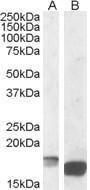 Anti-Tspo Antibody (A84643) (1 µg/ml) staining of Mouse Kidney lysate (A) and of Mouse Spleen lysate (B) (35 µg protein in RIPA buffer) Primary incubation was 1 hour Detected by chemiluminescence