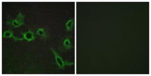 Immunofluorescence analysis of COS7 cells using Anti-HTR7 Antibody. The right hand panel represents a negative control, where the antibody was pre-incubated with the immunising peptide.