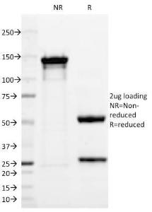 SDS-PAGE analysis of Anti-PGP9.5 Antibody [13C4] under non-reduced and reduced conditions; showing intact IgG and intact heavy and light chains, respectively. SDS-PAGE analysis confirms the integrity and purity of the antibody