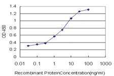 Anti-CAMK2B Mouse Monoclonal Antibody [clone: 4C7]