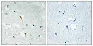 Immunohistochemical analysis of paraffin-embedded human brain using Anti-RBM6 Antibody 1:100 (4 °C overnight). The right hand panel represents a negative control, where the Antibody was pre-incubated with the immunising peptide