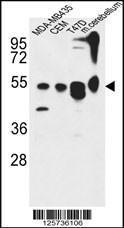 Anti-ATG13 Rabbit Polyclonal Antibody (APC (Allophycocyanin))