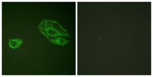 Immunofluorescence analysis of A549 cells using Anti-HER3 Antibody. The right hand panel represents a negative control, where the antibody was pre-incubated with the immunising peptide