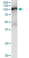 Anti-DVL2 Rabbit Polyclonal Antibody