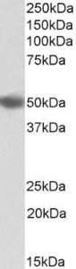 Anti-CD209 antibody