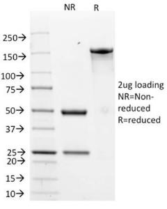 SDS-PAGE analysis of Anti-HER2 Antibody [ERB2/776] under non-reduced and reduced conditions; showing intact IgG and intact heavy and light chains, respectively. SDS-PAGE analysis confirms the integrity and purity of the antibody.