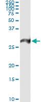 Anti-PSMA7 Mouse Monoclonal Antibody [clone: 1A10-3G12]