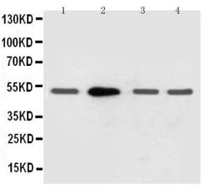 Anti-Muscarinic Acetylcholine Receptor 2 Rabbit Polyclonal Antibody