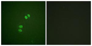 Antibody anti-PLK1 100 µg