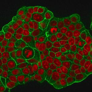 Immunofluorescent analysis of methanol fixed MCF-7 cells stained with Anti-HER2 Antibody [ERB2/776] followed by Goat Anti-Mouse IgG (CF&#174; 488) (Green). Nuclear counterstain is RedDot.