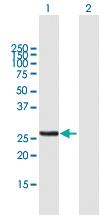 Anti-MTX2 Mouse Polyclonal Antibody