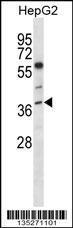 Anti-NEIL2 Rabbit Polyclonal Antibody (AP (Alkaline Phosphatase))