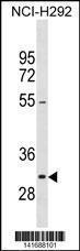 Anti-NIFK Rabbit Polyclonal Antibody (APC (Allophycocyanin))