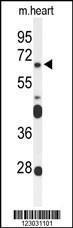 Anti-FZD4 Rabbit Polyclonal Antibody