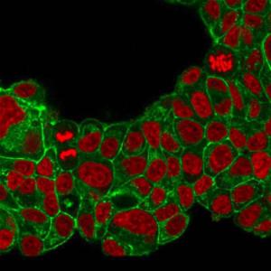 Immunofluorescent analysis of PFA fixed MCF-7 cells stained with Anti-HER2 Antibody [ERB2/776] followed by Goat Anti-Mouse IgG (CF&#174; 488) (Green). Nuclear counterstain is RedDot.