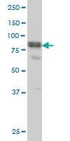 Anti-DVL3 Mouse Monoclonal Antibody [clone: 4H2]