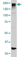 Anti-ARID1B Mouse Monoclonal Antibody [clone: 2D2]