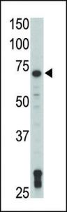 Anti-TXK Rabbit Polyclonal Antibody (HRP (Horseradish Peroxidase))