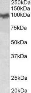 Antibody anti-amyloid precursor protein